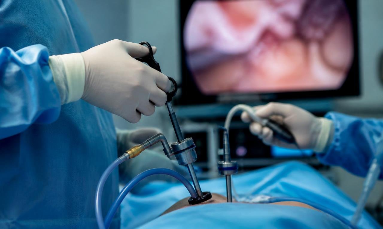 Minimally invasive laparoscopic cancer surgery in progress